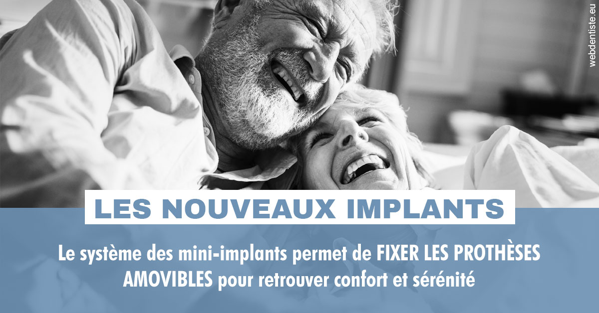 https://dr-coulange-jacques.chirurgiens-dentistes.fr/Les nouveaux implants 2