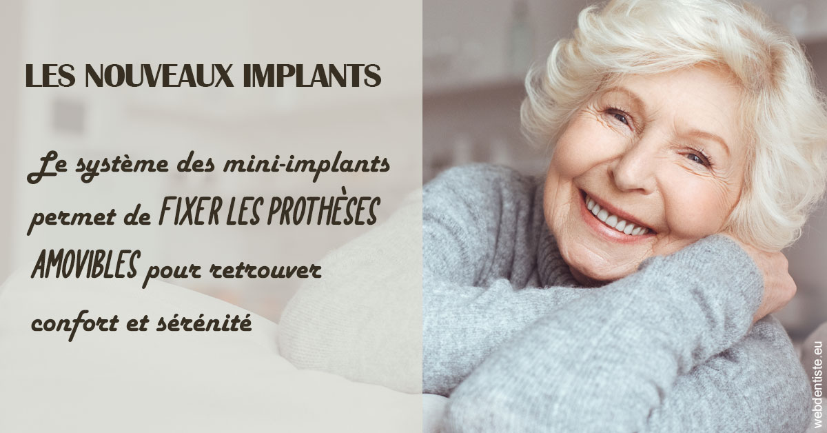 https://dr-coulange-jacques.chirurgiens-dentistes.fr/Les nouveaux implants 1