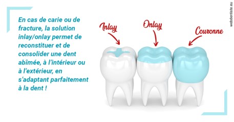 https://dr-coulange-jacques.chirurgiens-dentistes.fr/L'INLAY ou l'ONLAY