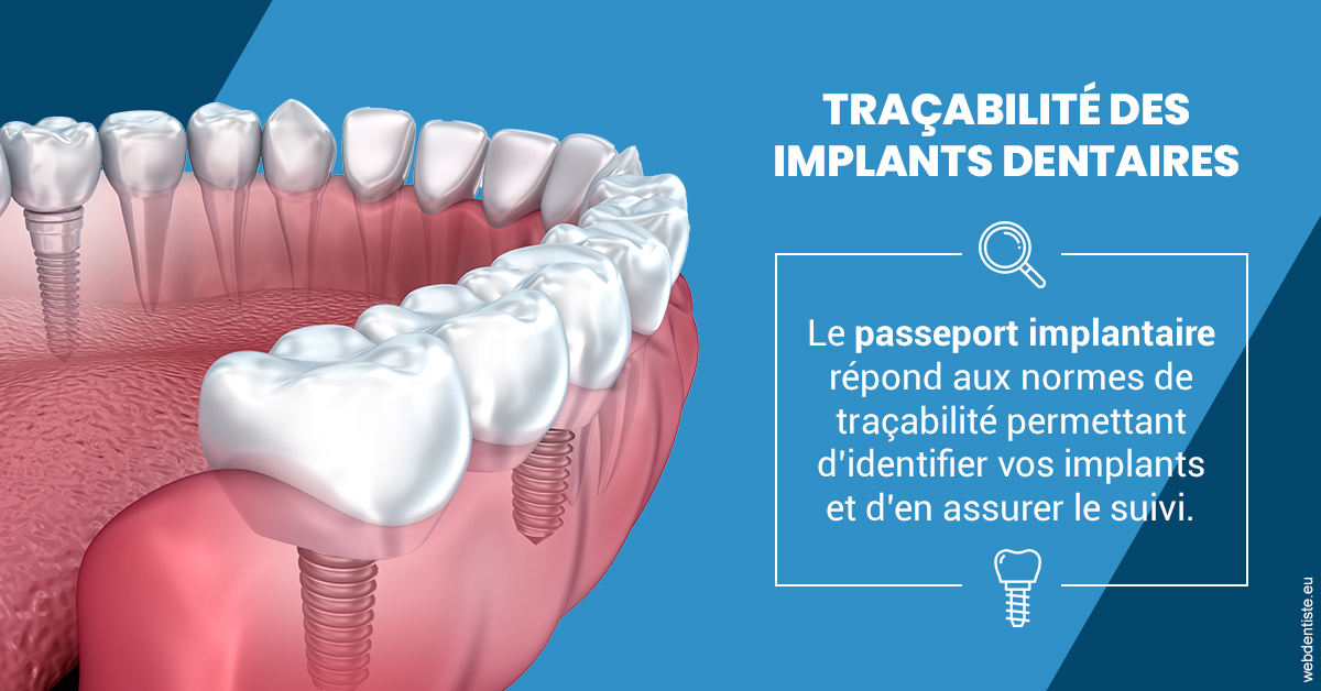 https://dr-coulange-jacques.chirurgiens-dentistes.fr/T2 2023 - Traçabilité des implants 1