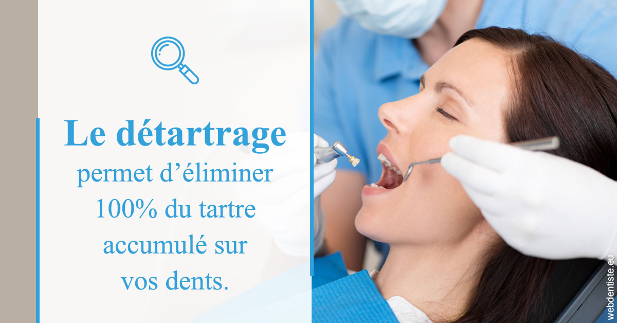 https://dr-coulange-jacques.chirurgiens-dentistes.fr/En quoi consiste le détartrage