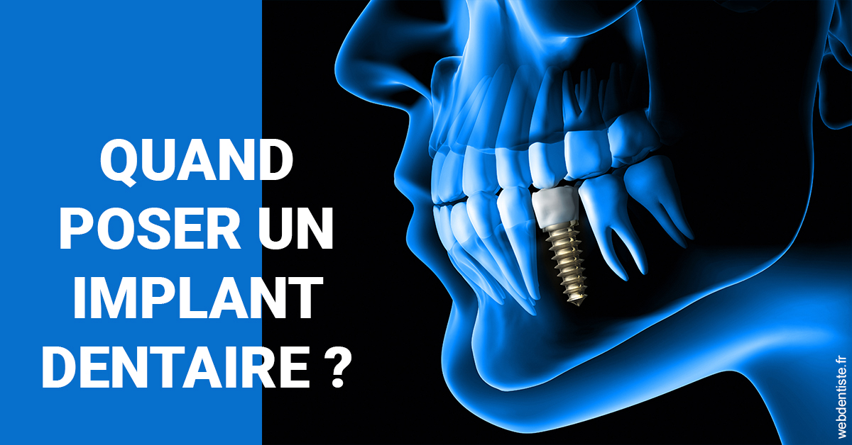 https://dr-coulange-jacques.chirurgiens-dentistes.fr/Les implants 1