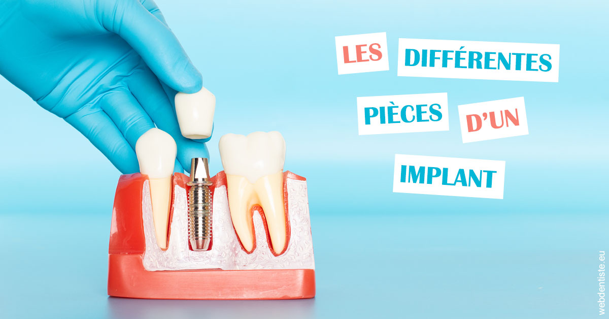 https://dr-coulange-jacques.chirurgiens-dentistes.fr/Les différentes pièces d’un implant 2