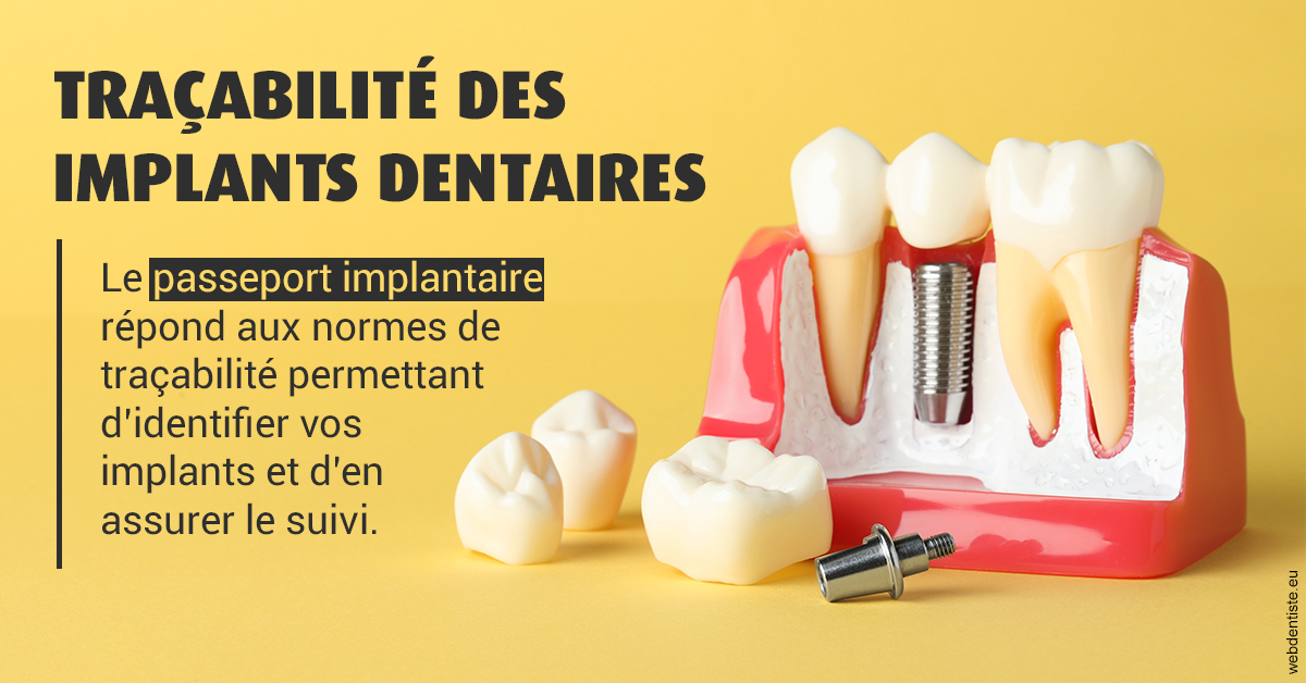 https://dr-coulange-jacques.chirurgiens-dentistes.fr/T2 2023 - Traçabilité des implants 2