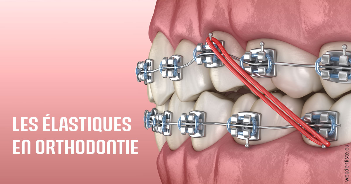 https://dr-coulange-jacques.chirurgiens-dentistes.fr/Elastiques orthodontie 2